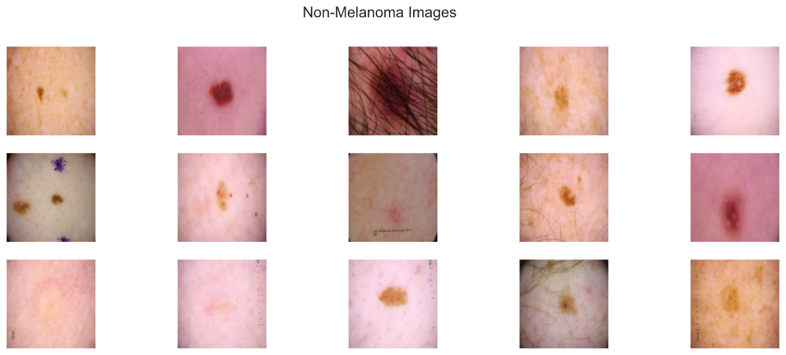 Non-Melanoma Images